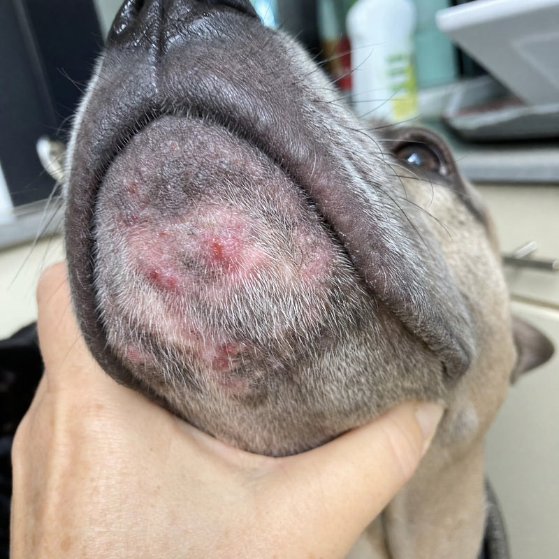Painful Chin Acne